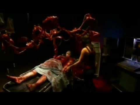 Autopsy