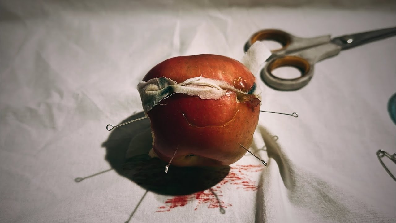 Apple Boy
